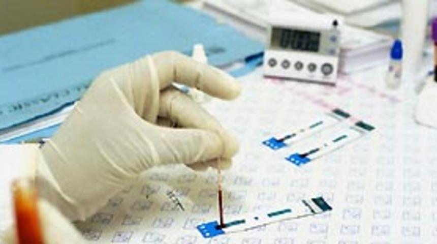 Cinsel yolla bulaşan hastalıklar hangileri?