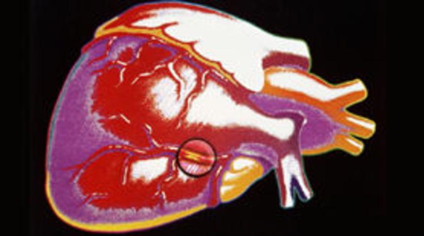 Kalp ve damar hastalıklarına karşı uyarı