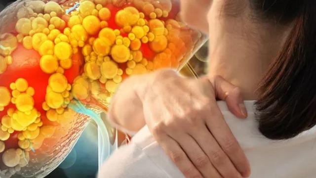Boyun, omuz ve eklemlerdeki ağrıya dikkat! Tehlikeli hastalığın belirtisi olabilir