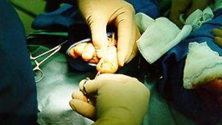 Tırnak batmasının sebepleri