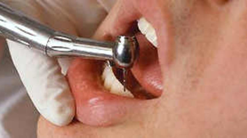 Diş gıcırdatma, hasarlara sebep oluyor