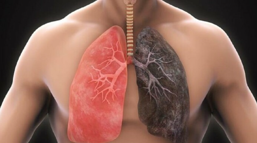 Sigara bağımlıları dikkat: 3 günde ciğerleri tertemiz yapıyor! Vücutta toksin bırakmıyor