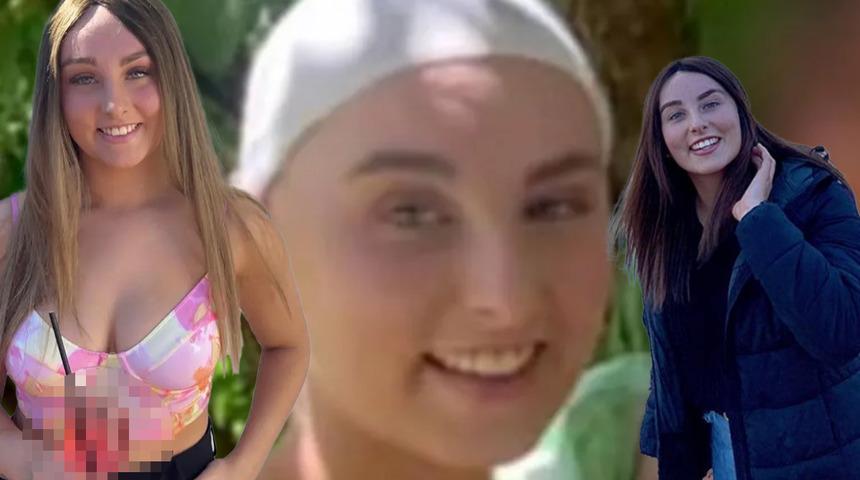 Korkunç iş kazası! Saçları fabrikadaki makineye dolanınca kafa derisi tamamen koptu... Herkes öleceğini zannetmişti 