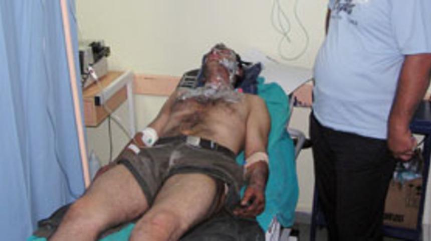 Akaryakıt deposu patladı: 2 yaralı