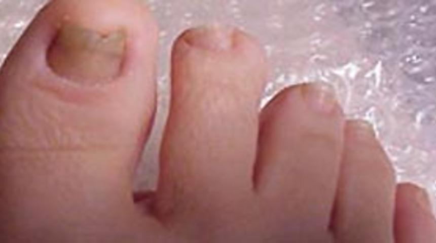 Soru-cevaplarla 'Ayak Mantarı '