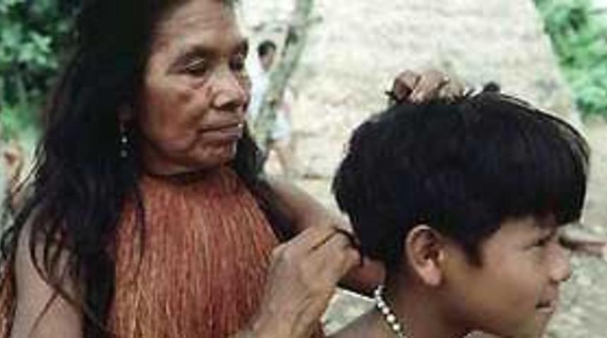 Saç bitinin trajikomik tarihi