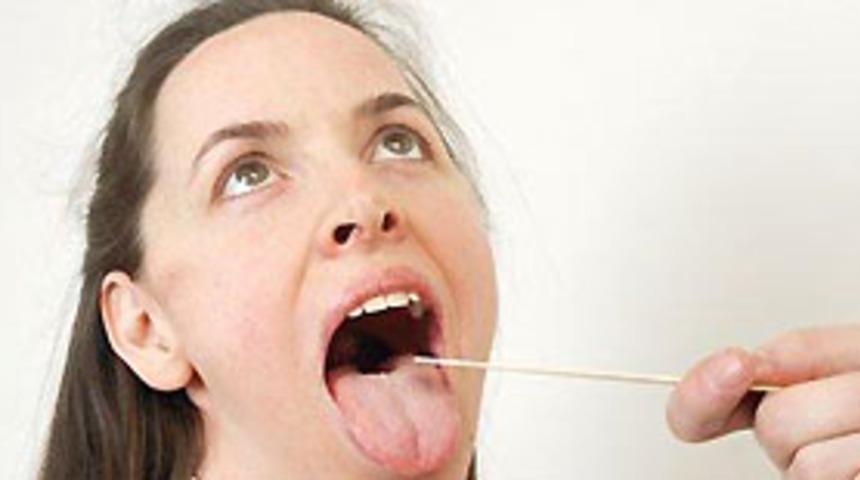 Damak yarığında erken tedavi şart