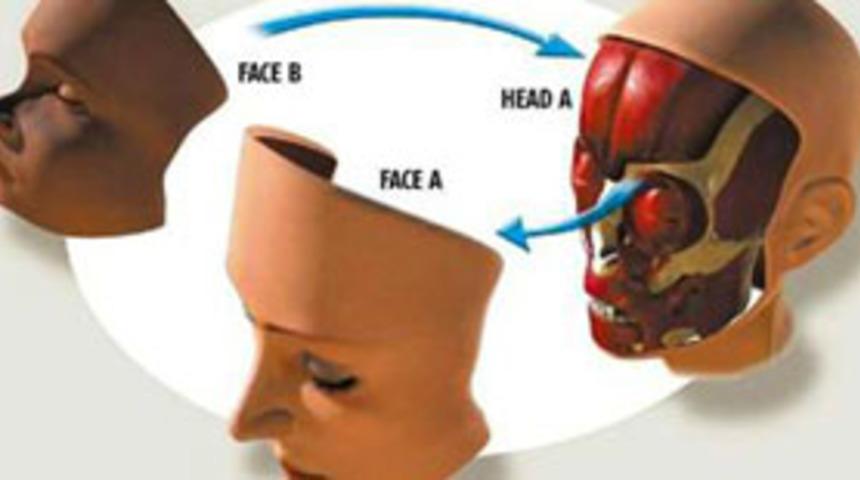 Yüz naklinde doku uyumu çok önemli