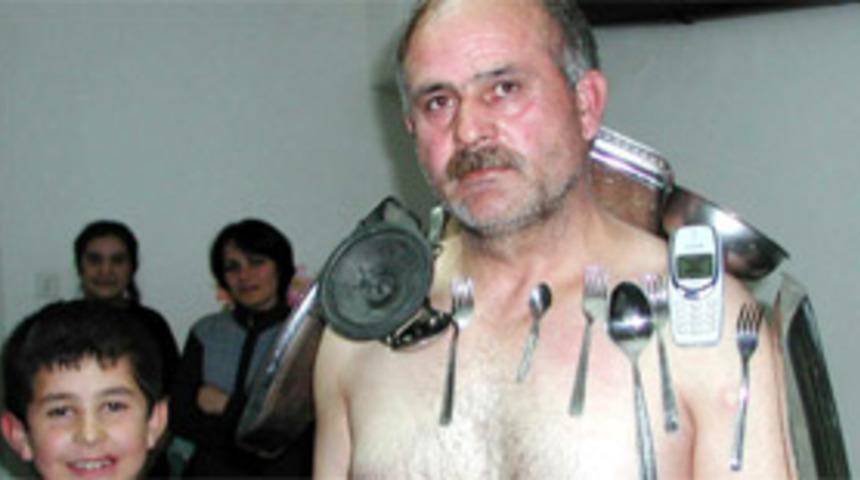 Mıknatıs adam, enfeksiyon kapıp &ouml;ld&uuml;