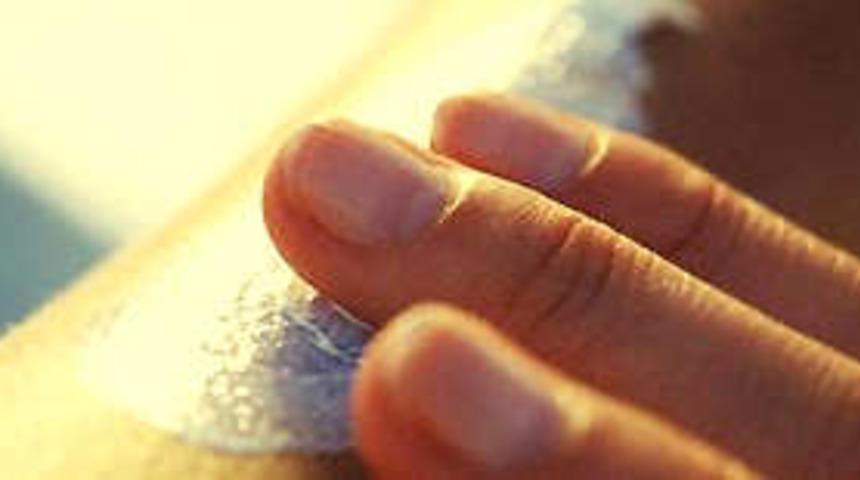 V&uuml;cuttaki benler kanser habercisi mi?