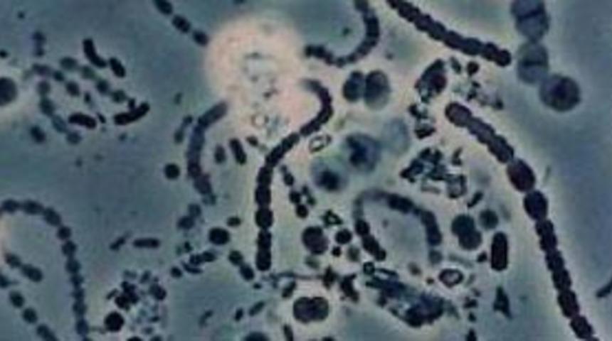 Sağlık müdürlüğü'nden bakteri uyarısı