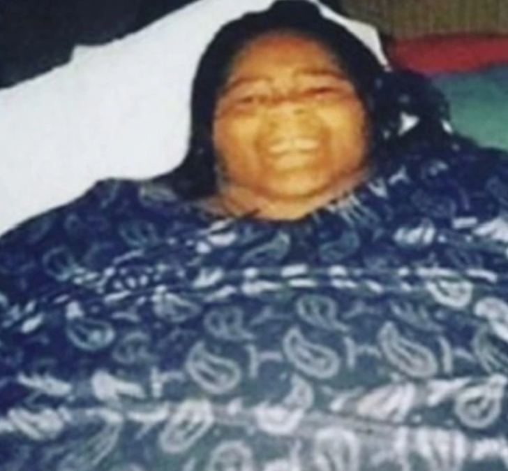 Dünyanın en şişman kadınlarından biriydi! Odasından vinçle taşınmak zorunda kalmıştı... Son hali inanılmaz G1