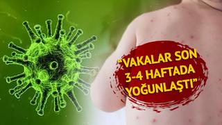 Vakalar en çok İstanbul'da! Avrupa yakasında tehlike daha fazla...  'Kızamık için korkutan uyarı: Son 3-4 haftadır yoğunlaştı'
