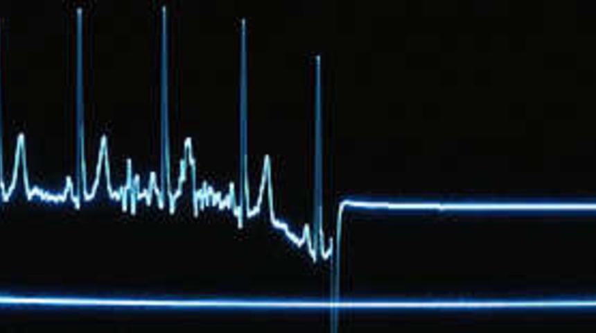 "Kalp krizini &ouml;nleyen protein" bulundu