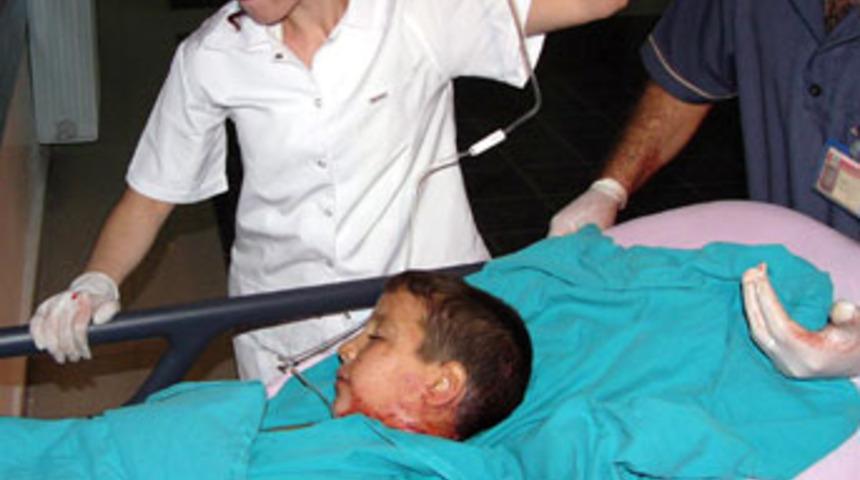 K&ouml;pek saldırısına uğrayan &ccedil;ocuk konuşamıyor