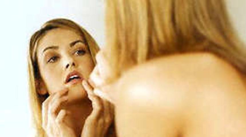 Akne hakkında bilmediğimiz ger&ccedil;ekler