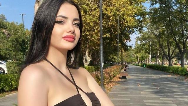 Kısmetse Olur Elif Nur Yel'in estetiksiz hali sosyal medyanın diline düştü! Değişimi herkesi şaşırttı