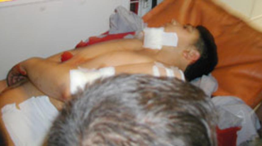 Gasp&ccedil;ılara direndi, 32 yerinden bı&ccedil;aklandı