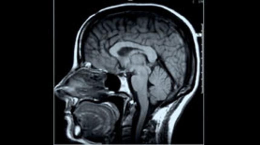 Beyinde 'tanrı noktası' yokmuş
