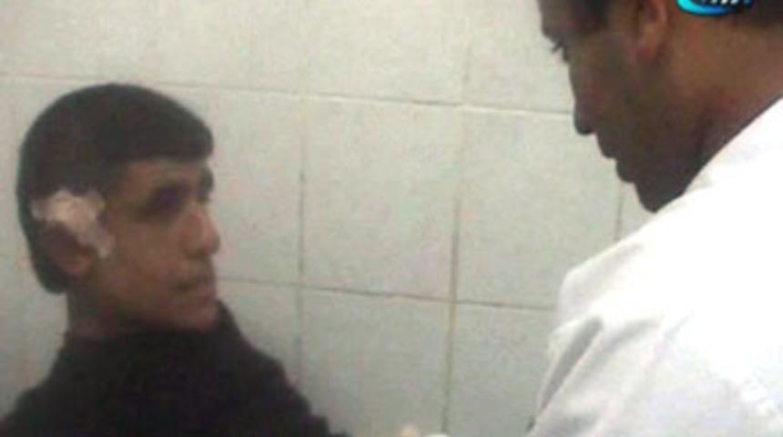 Kulak kesiği i&ccedil;in gitti, s&uuml;nnet olup &ccedil;ıktı