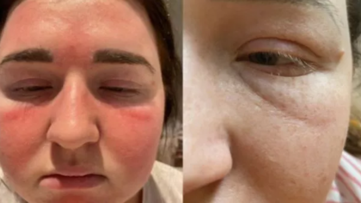 Semptomları korkunç! “İntihar hastalığı” teşhisi konuldu... Ağrıdan hareket dahi edemiyor G2