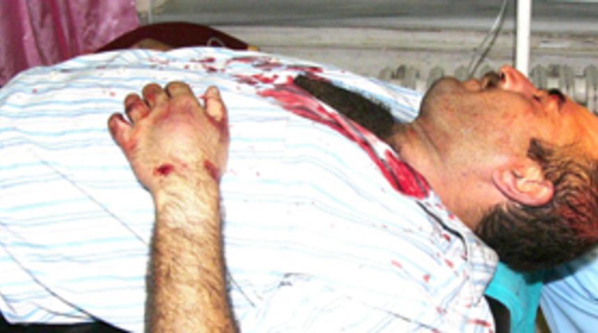 Uyurken sopalı saldırıya uğradı