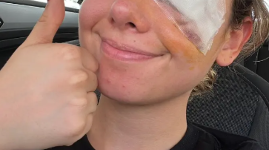 Popüler güzellik tüyosu başına bela oldu! Sosyal medyada görmüştü... Göz ameliyatı olması gerekti