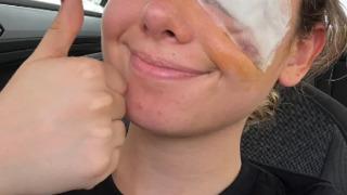 Popüler güzellik tüyosu başına bela oldu! Sosyal medyada görmüştü... Göz ameliyatı olması gerekti