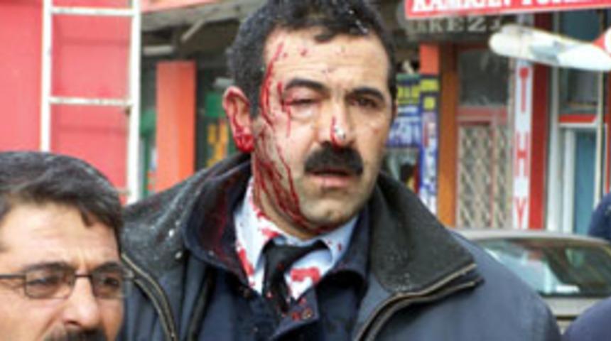 "Yaralılardan 3'&uuml;n&uuml;n durumu ağır''