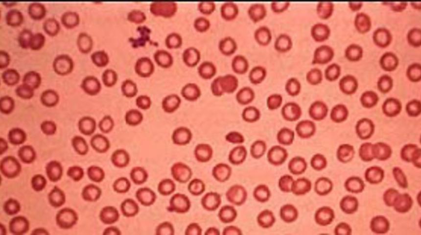 Akdeniz Anemisi hakkında uyarılar