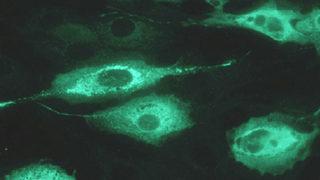 Sağlık Bakanlığı'ndan verem raporu