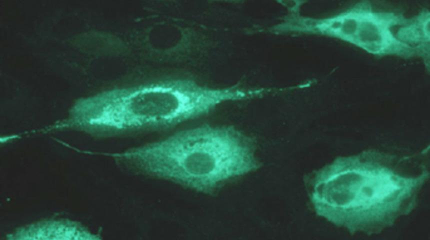 Sağlık Bakanlığı'ndan verem raporu