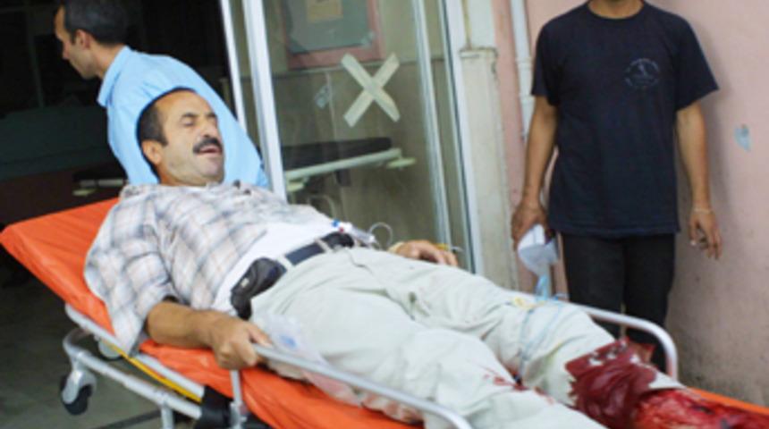 Camdan &ccedil;ıkardığı bacağına kamyon &ccedil;arptı