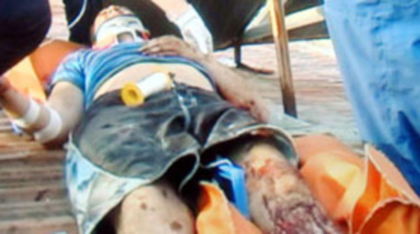 Boşluğa d&uuml;şen turist kurtarıldı