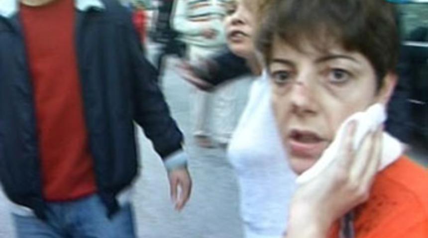 Kadınlar birbirine girdi: 1 yaralı