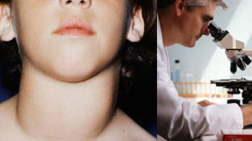 Tiroid (Guatr) bezi nedir? Tedavisi nasıldır?