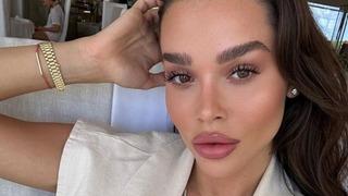 Fenomen Ezgi Fındık’ın estetiksiz halini görenler çok şaşırdı! “Yüz nakli yaptırmış gibi”