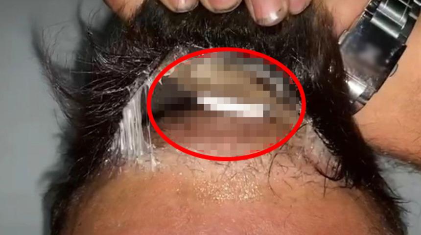 Peruğundan çıktı, gören şaşkına döndü! Gözaltına alındı