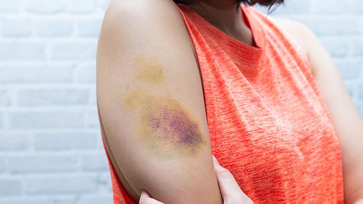 Önemsiz deyip geçmeyin! Kolajen eksikliğinin 8 belirtisi G3