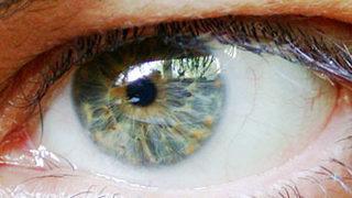 Göz tembelliğinde tedavi zamanı önemli