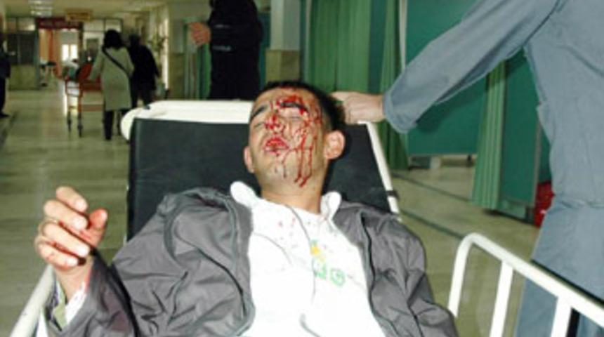 &Ouml;ğrenciye d&ouml;ner bı&ccedil;aklı saldırı