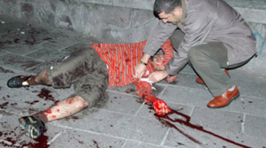 Başkent'te şehir eşkiyaları dehşet sa&ccedil;tı