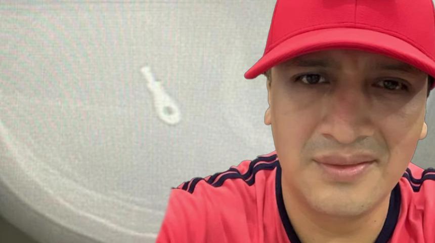 Burun ameliyatı olan otel çalışanı hayatını kaybetti! Gerçek röntgen sonuçlarıyla ortaya çıktı... “Küçük bir metal kelepçe...”