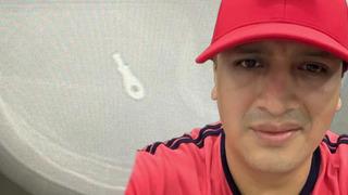 Burun ameliyatı olan otel çalışanı hayatını kaybetti! Gerçek röntgen sonuçlarıyla ortaya çıktı... “Küçük bir metal kelepçe...”