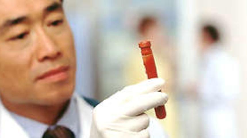 Beyin hastalıklarına kan tahliliyle teşhis