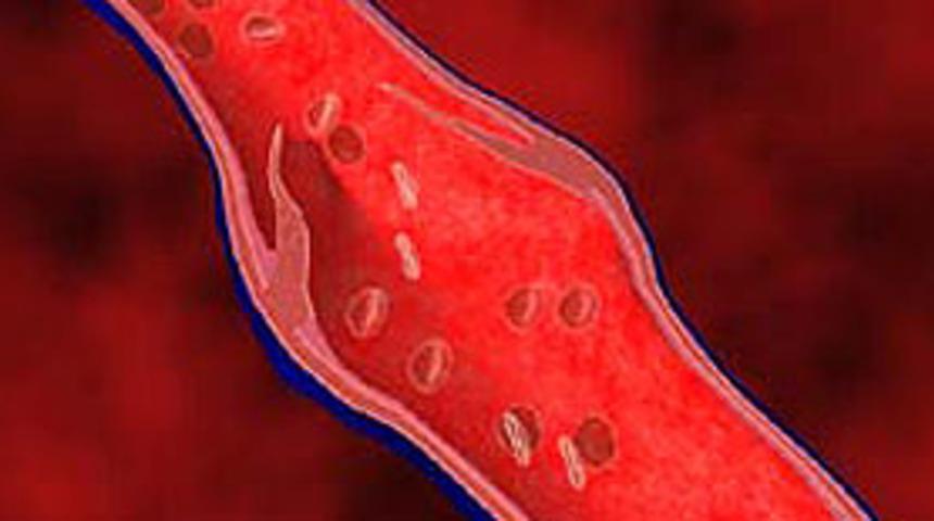 Damar sertliği ila&ccedil;la azaltıldı