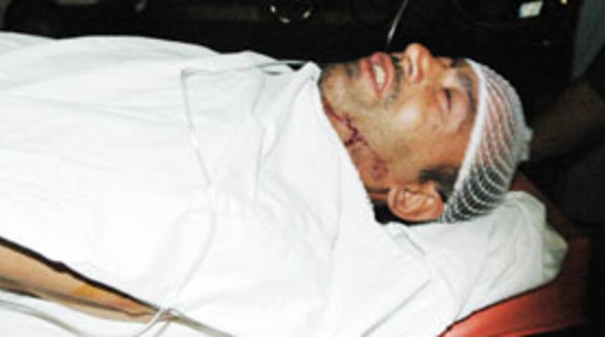 Karısından dayak yiyen koca hastanelik oldu