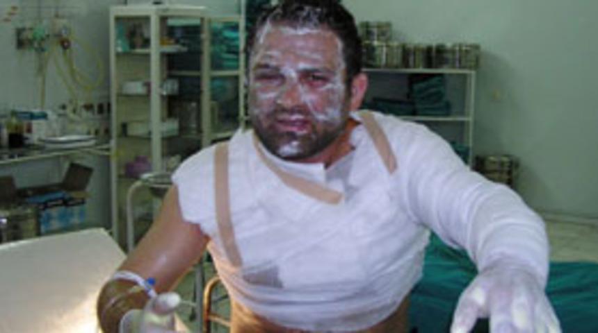 Sevgilinin &uuml;zerine kızgın yağ d&ouml;kt&uuml;