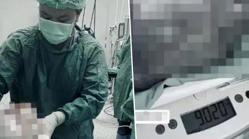 Engel olamadığı bir şekilde devamlı kilo alıyordu! Nedeni yumartalık kistiymiş...Doktorlar bile şaşkına döndü