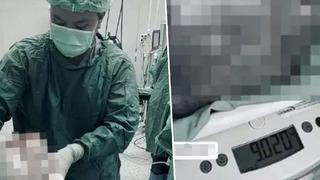 Engel olamadığı bir şekilde devamlı kilo alıyordu! Nedeni yumartalık kistiymiş...Doktorlar bile şaşkına döndü